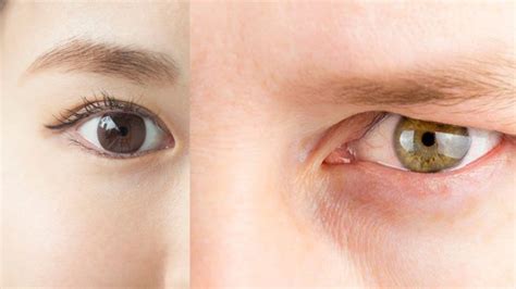 monolid ogen|The Difference Between Monolids and Double Eyelids。